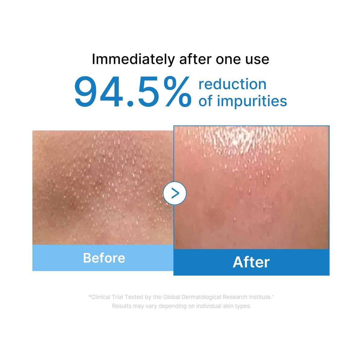 Medicube Pore Blackhead Deep Cleansing Oil, hidrofilā eļļa